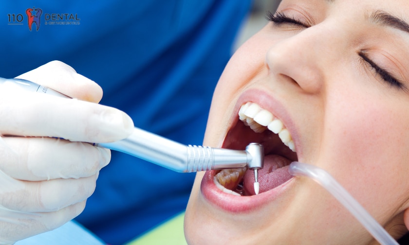 A Complete Guide to Root Canal Therapy For You