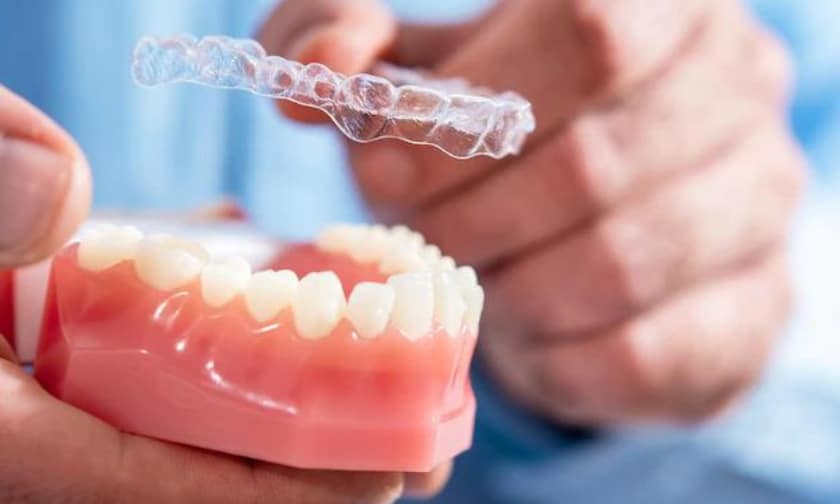 3 Reasons You Should Consider Before Getting Invisalign
