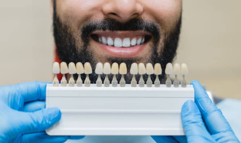 What to Consider Before Getting Dental Veneers
