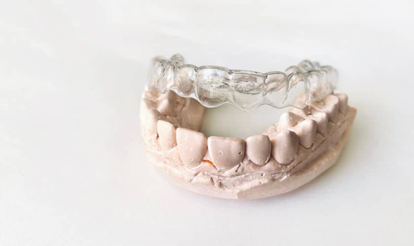 Orthodontic Treatment For Adults: It’s Never Too Late To Straighten Your Teeth