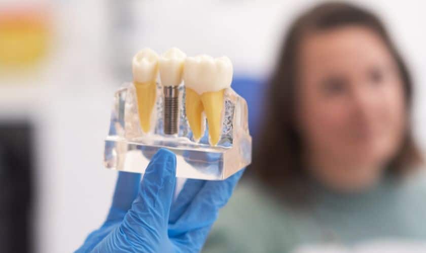 The Ultimate Solution For Missing Teeth: Dental Implants In Whitehouse