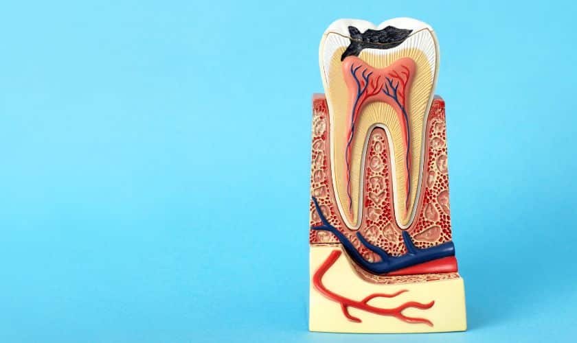 Beyond The Stereotypes: Debunking Myths About Root Canal Treatment