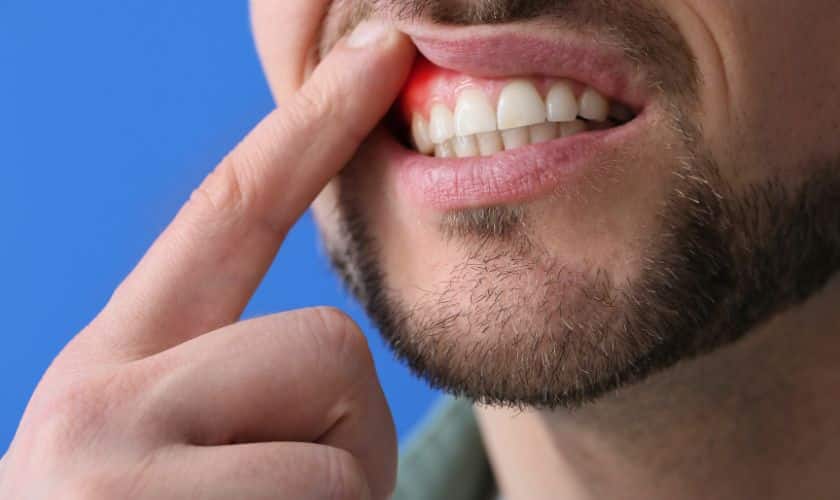 From Gingivitis to Gleaming Gums: Navigating Effective Treatment Paths