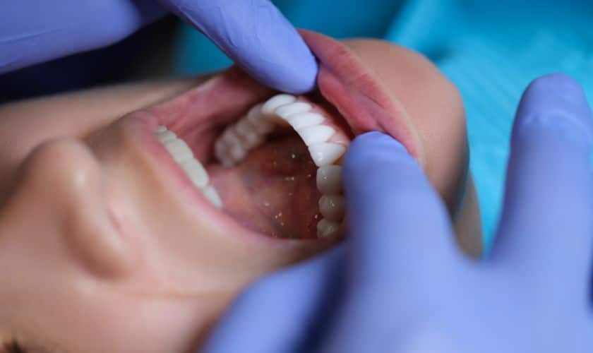 Oral Cancer Awareness Month – APRIL: Spread the Awareness
