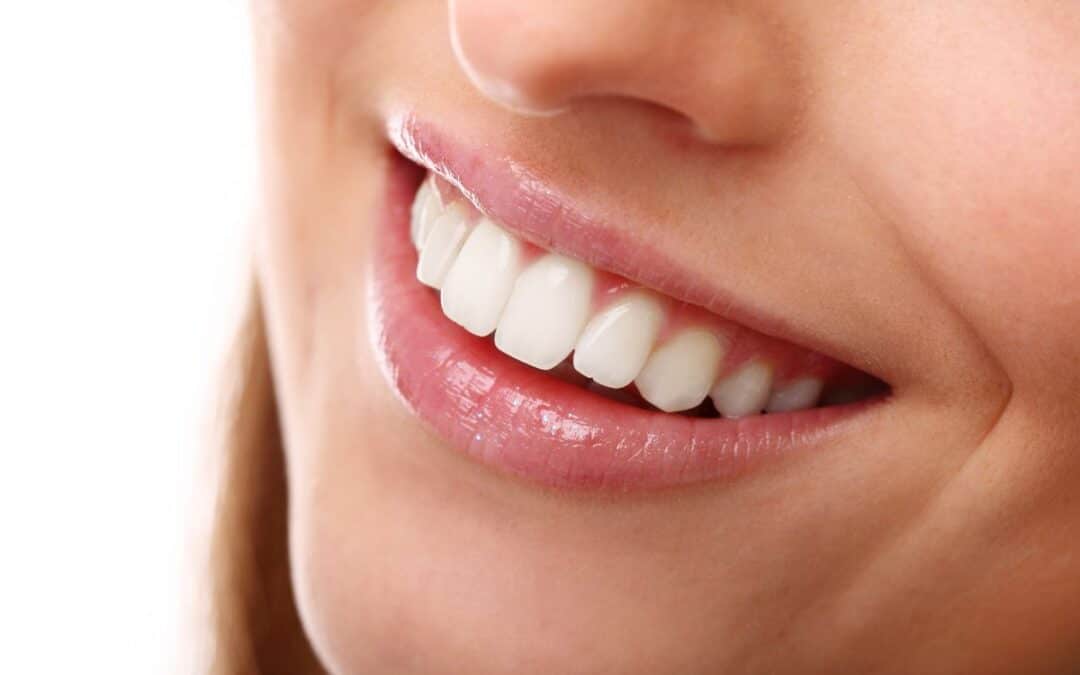 How to Achieve a Bright Smile for Valentine’s Day?