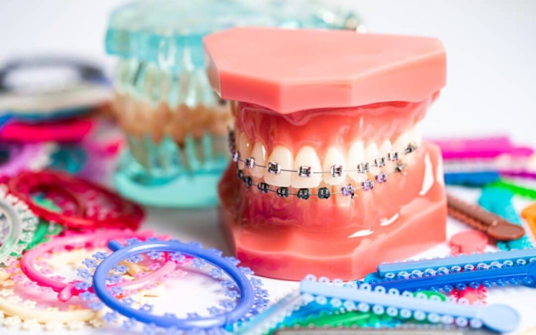 Symptoms of an Orthodontic Emergency