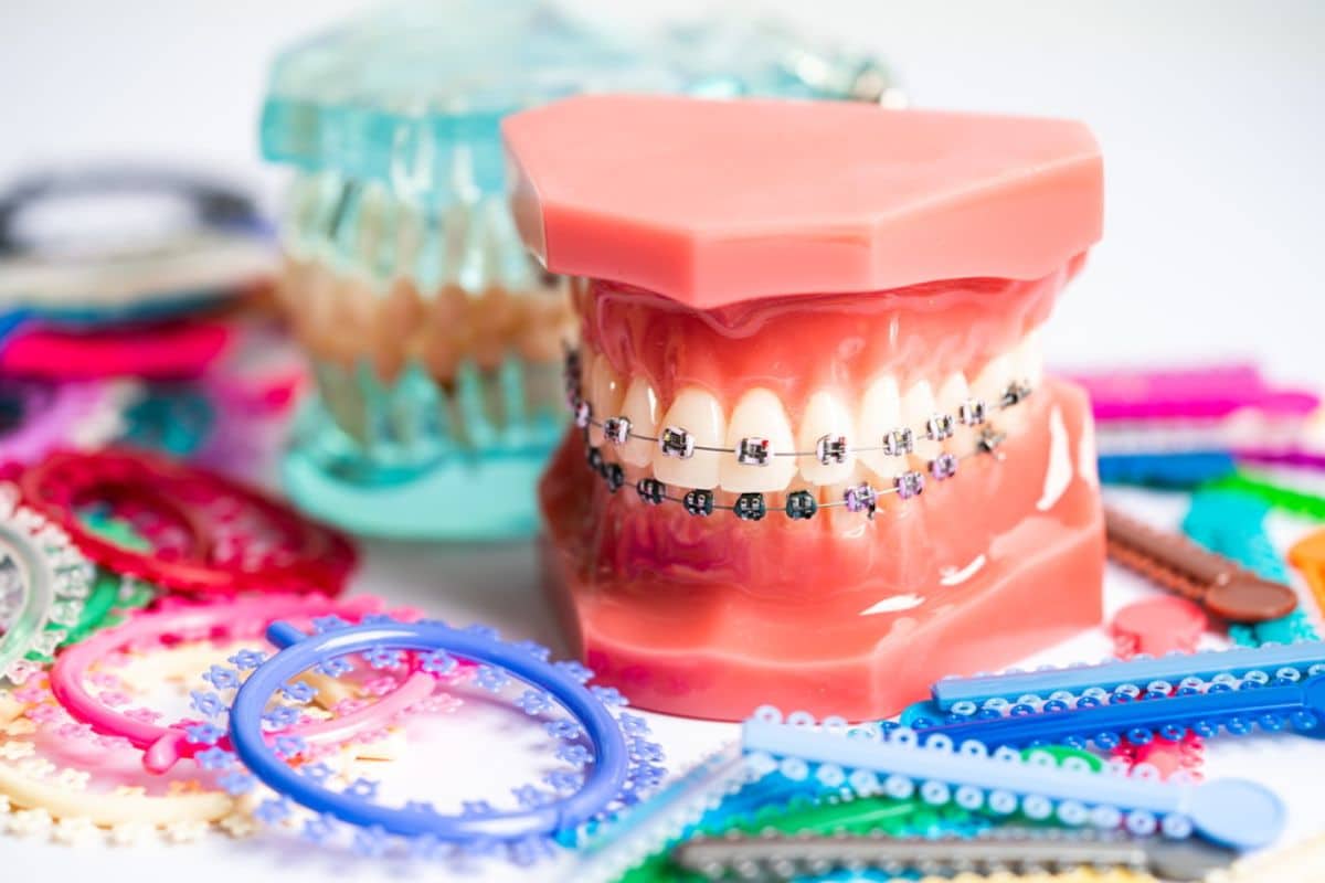 What Are the Symptoms of an Orthodontic Emergency?