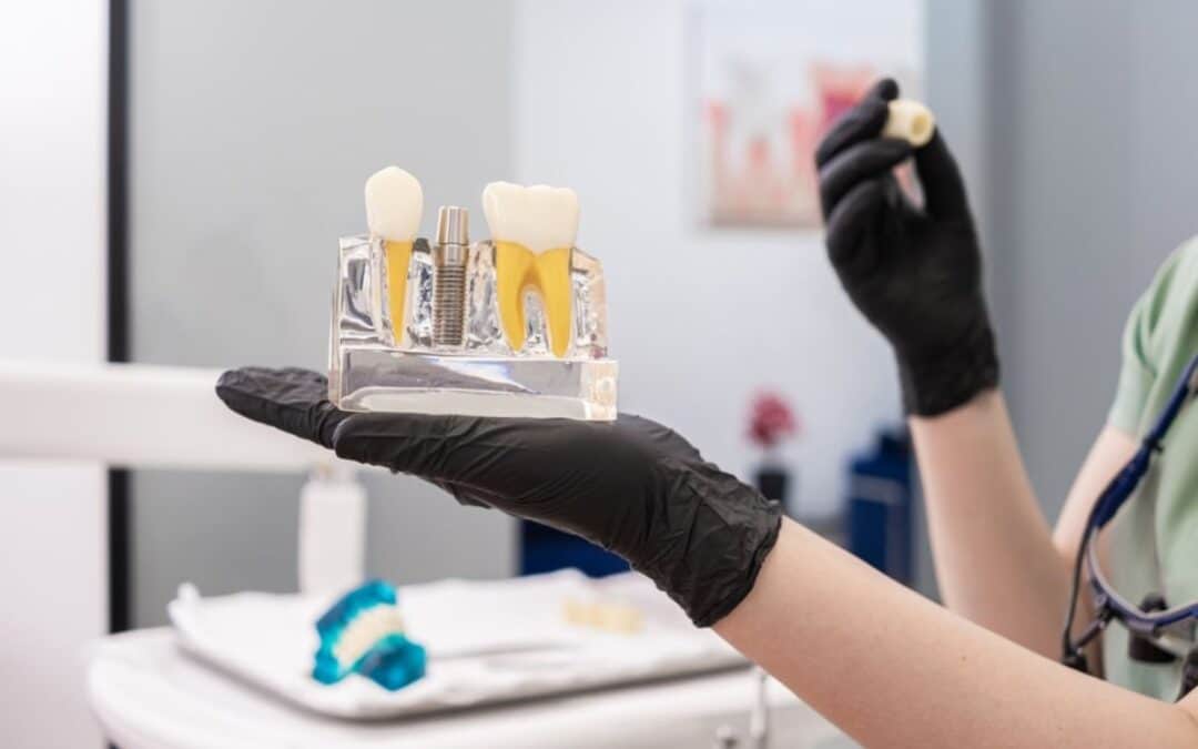 Can a Dental Implant Get Infected? Warning Signs & Solutions