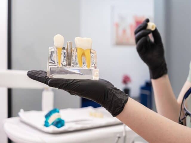 Can a Dental Implant Get Infected? Warning Signs & Solutions