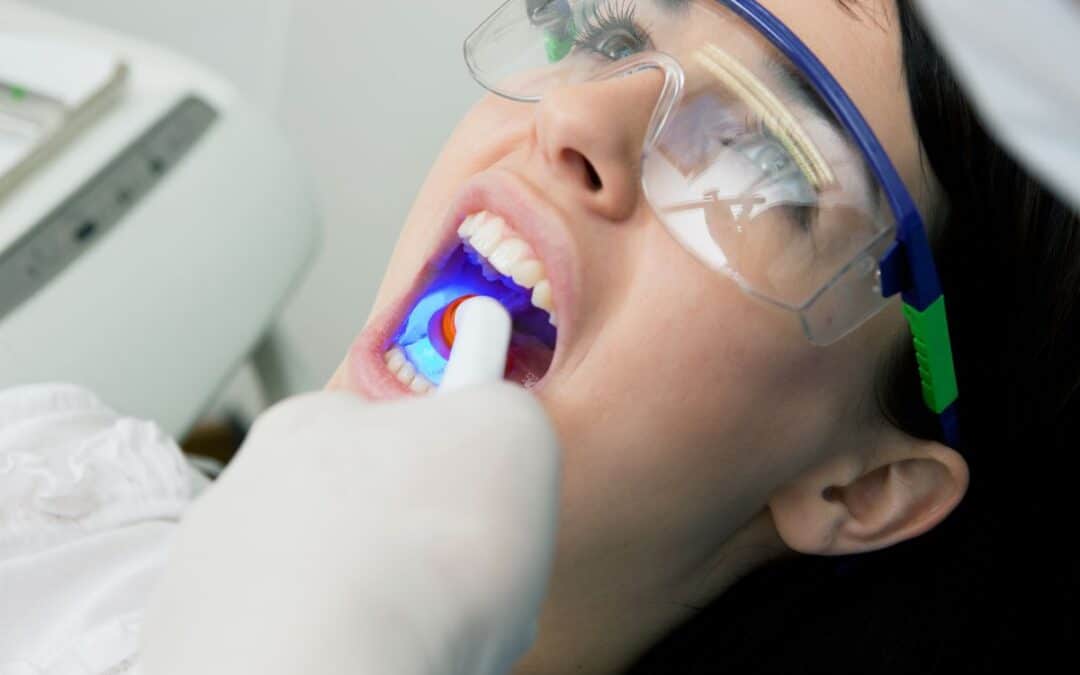 How Does My General Dentist Decide If I Need a Filling?