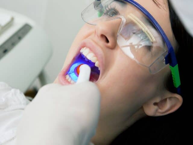 How Does My General Dentist Decide If I Need a Filling?