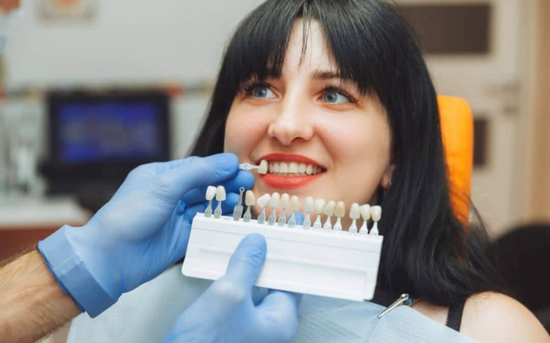 How to Care for Your Veneers: Tips and Tricks