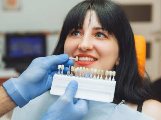 How to Care for Your Veneers: Tips and Tricks