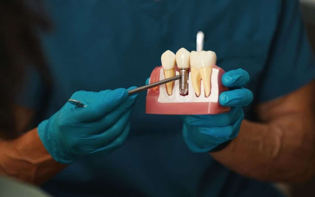 Dental Implants for Diabetics: What Whitehouse Residents Should Know