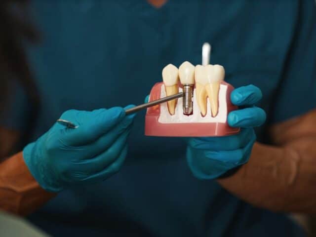 Dental Implants for Diabetics: What Whitehouse Residents Should Know