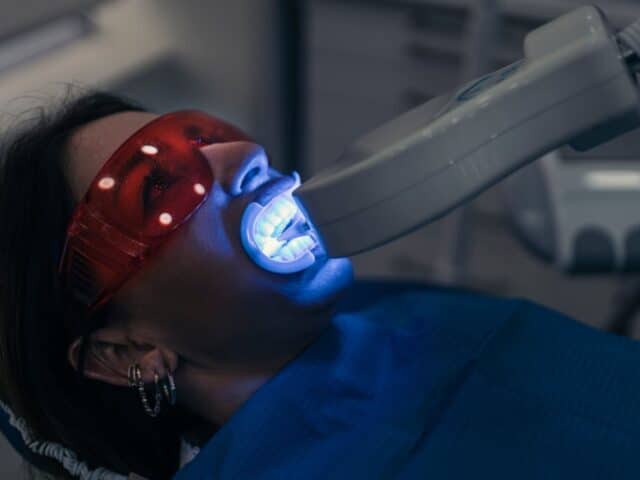 How Cosmetic Dentistry in Whitehouse, TX Creates Lasting White Smiles