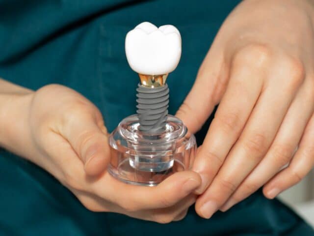 How to Clean and Care for Your Dental Implants