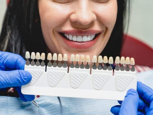 Can You Get Veneers If You Have Bruxism?