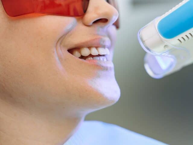 What’s the Difference Between Cosmetic and General Dentistry?