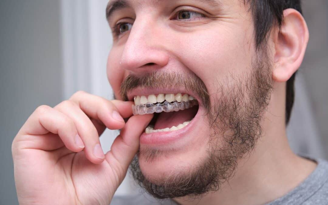 Can Invisalign Resolve the Crowded Teeth You’ve Always Wanted to Fix?