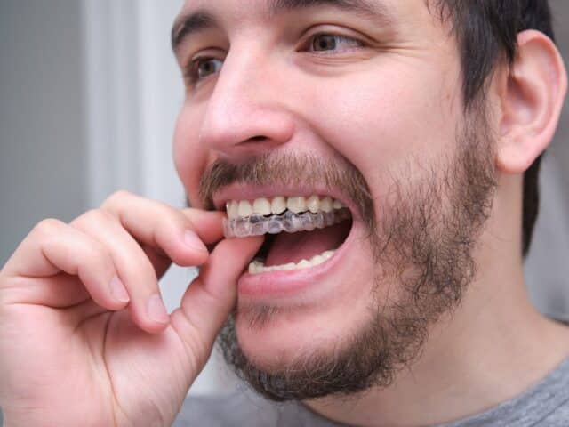 Can Invisalign Resolve the Crowded Teeth You’ve Always Wanted to Fix?