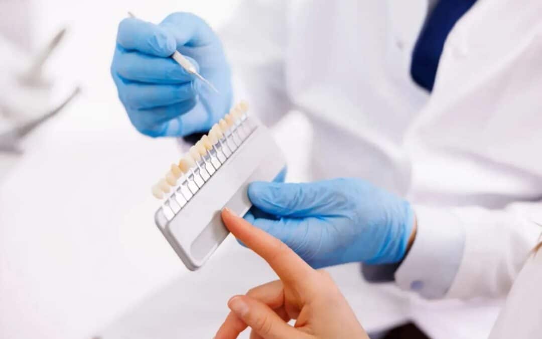 Are Veneers the Ideal Solution for Your Worn or Chipped Teeth?