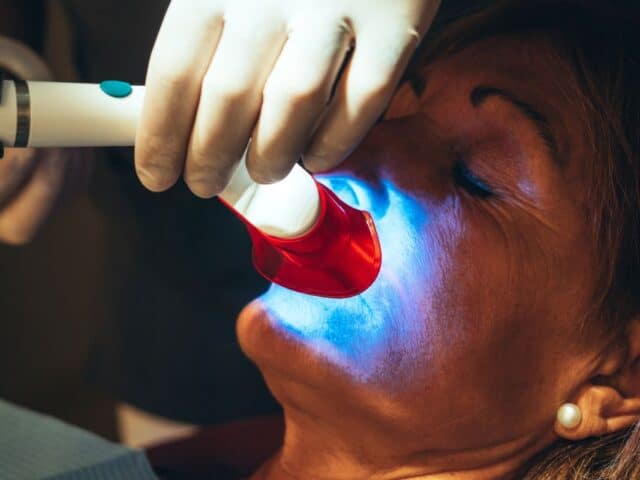 Can a Professional Whitening Treatment Boost Your Confidence?