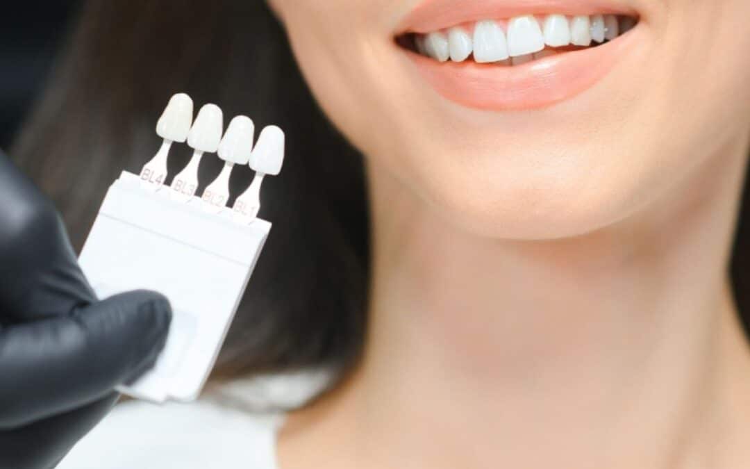 Will Veneers Change How I Speak or Bite?