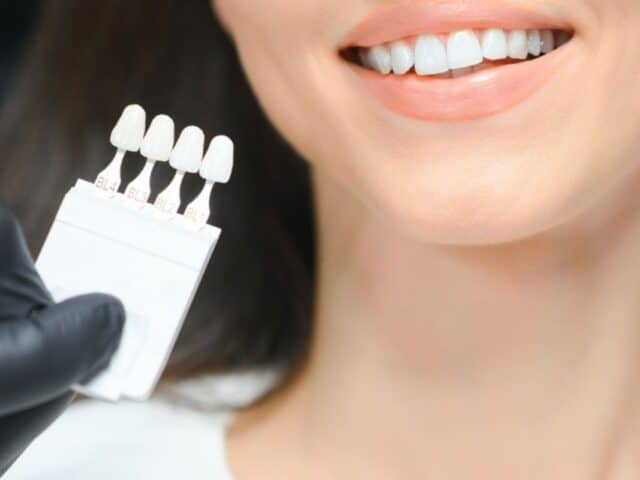 Will Veneers Change How I Speak or Bite?