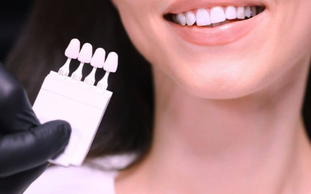 can-a-cosmetic-dentist-in-whitehouse-fix-uneven-teeth-without-braces