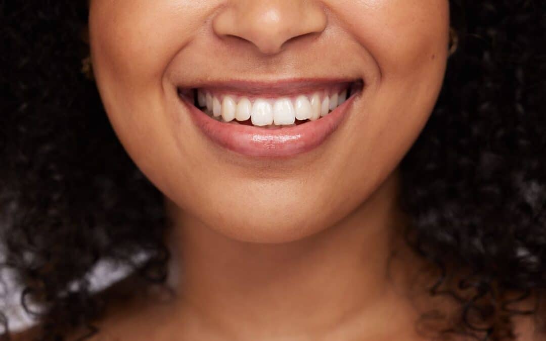 does-teeth-whitening-in-whitehouse-tx-work-on-naturally-dark-tooth-shades