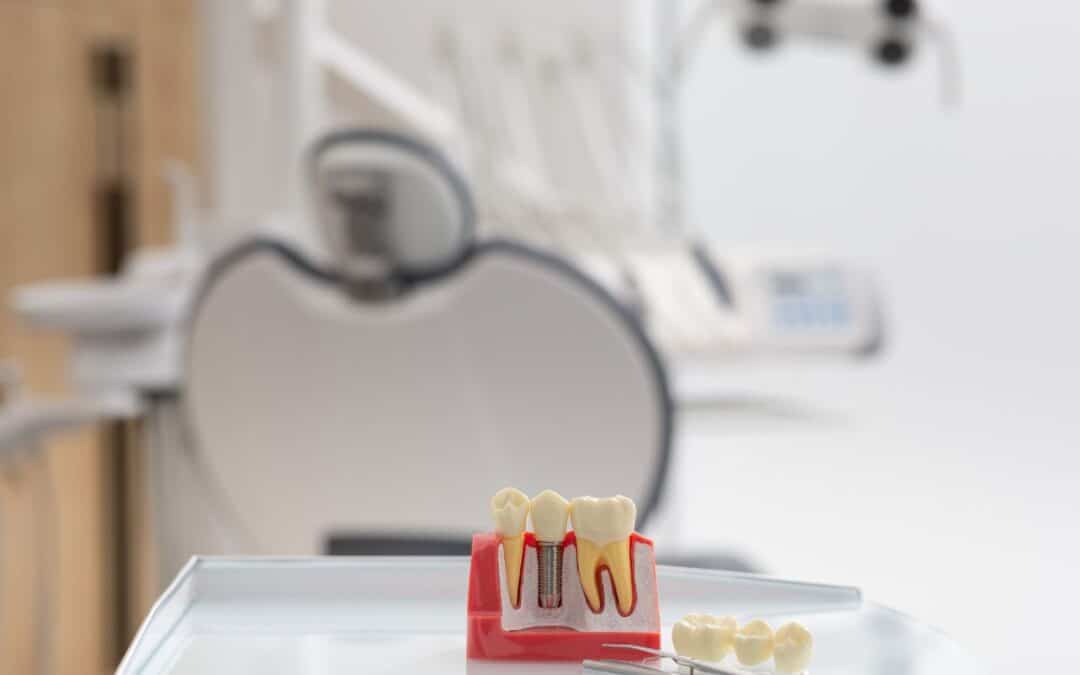 how-do-dental-implants-in-whitehouse-prevent-jawbone-deterioration